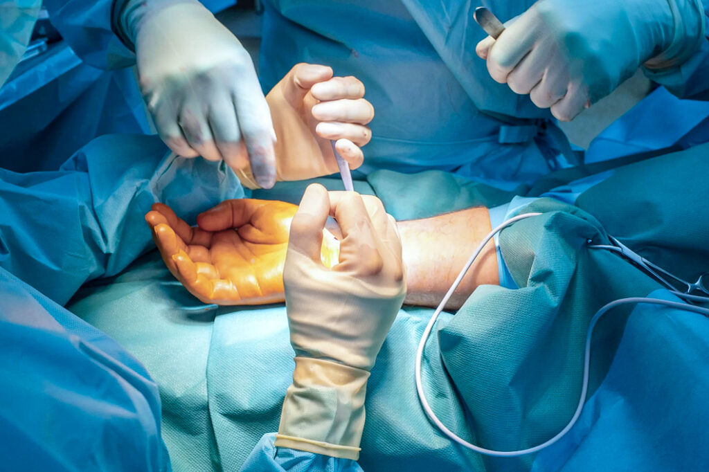 Hand and micro surgeries