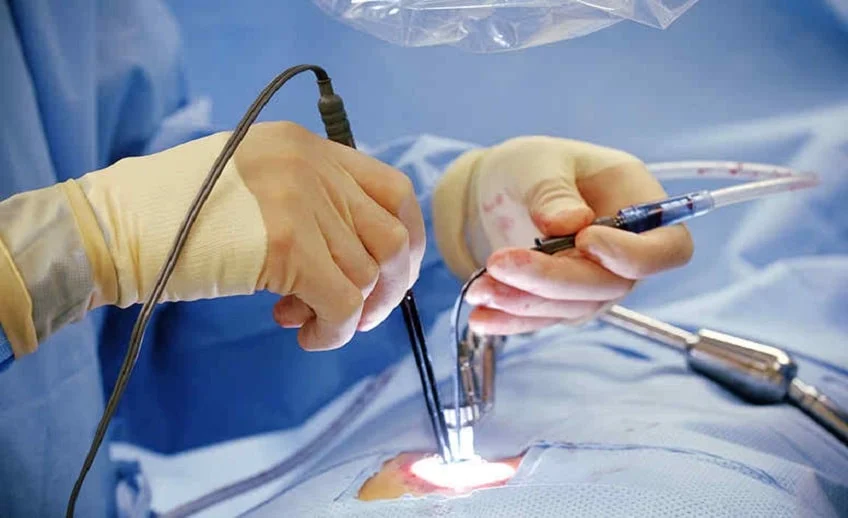Spine surgery